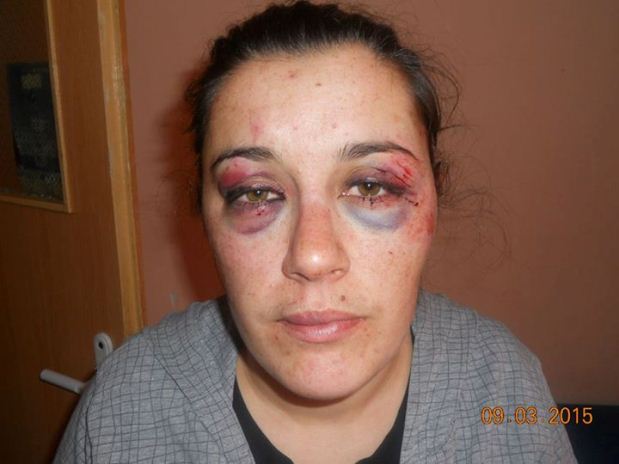 Цигани пребиха млада жена от Самоков за 20 лева